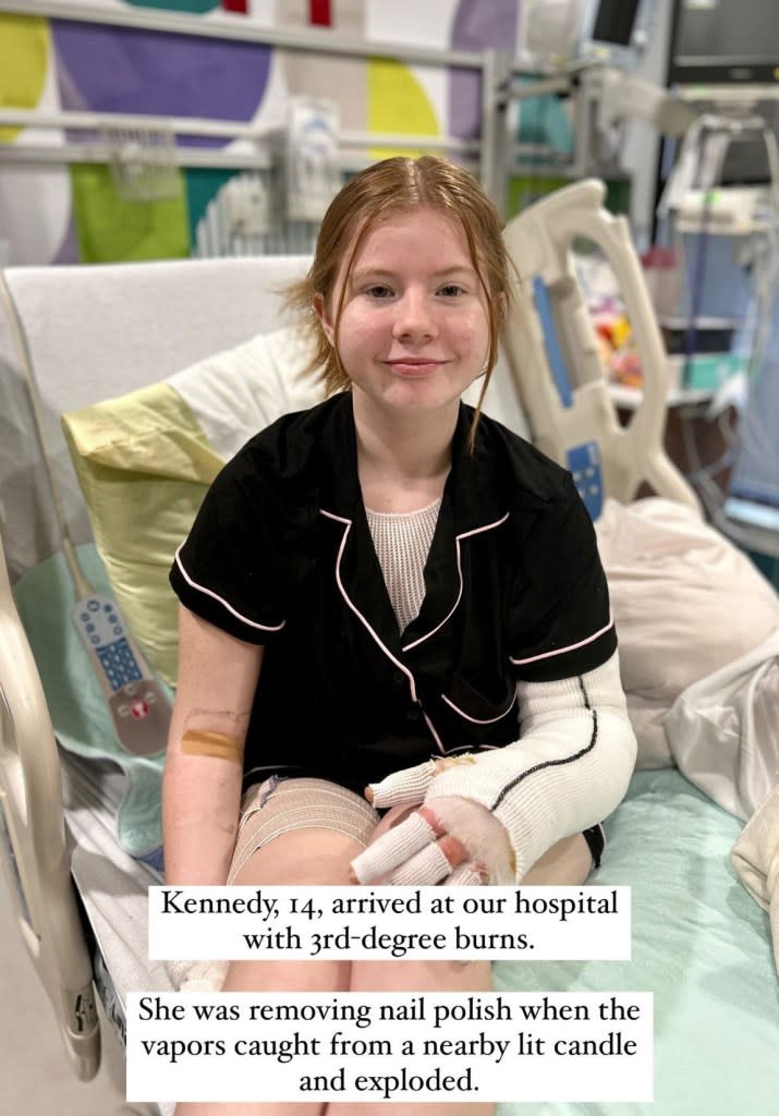 Kennedy, 14, caught fire when she was removing her nails for a school basketball game. Facebook/Shriners Children's Ohio