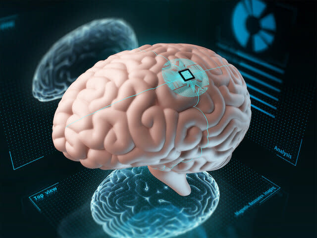 Chip implanted in human brain