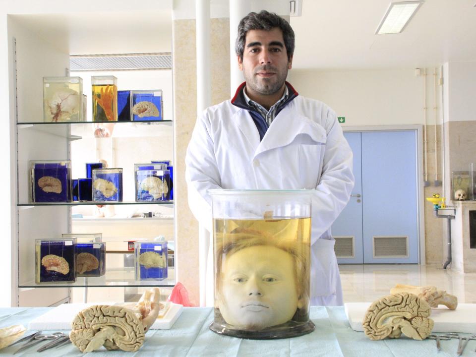 Diogo Alves's head in a fluid-filled jar with a man in a lab coat standing behind it