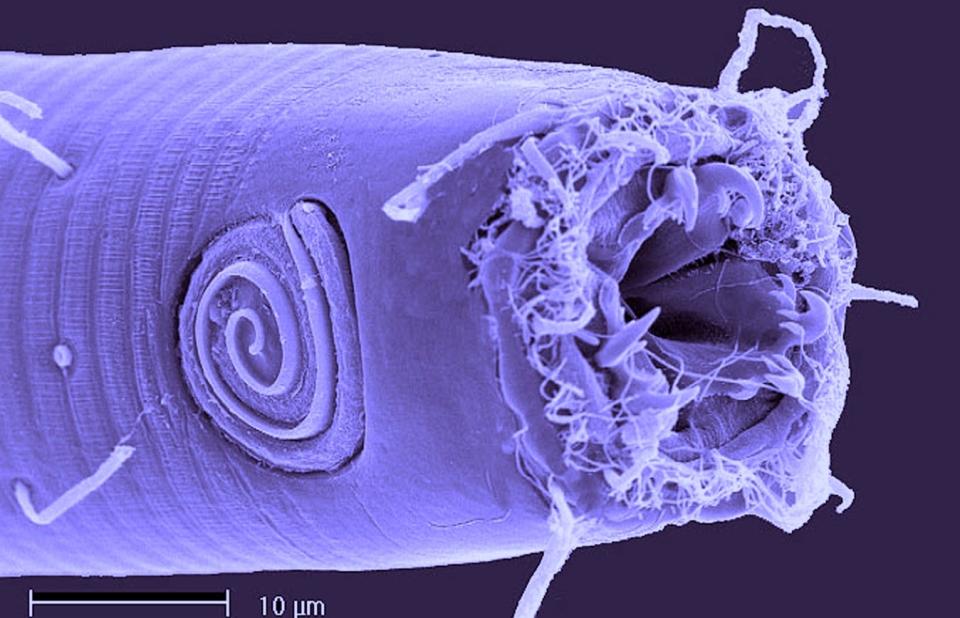 Microscopic image of a odontophora nematode.