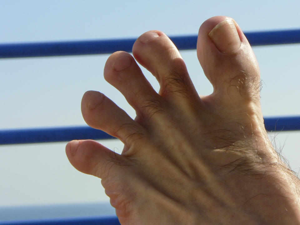 Close-up of a person's bare foot with toes spread out against a blue background