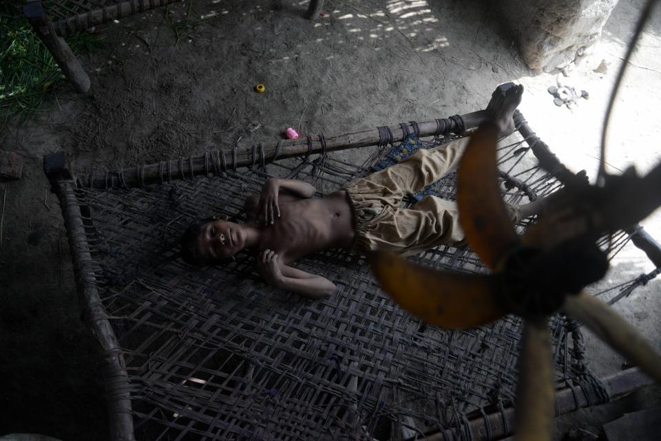 An emaciated child seeks relief under a solar-powered fan, charged by a small battery in his home in Jacobabad, Pakistan.