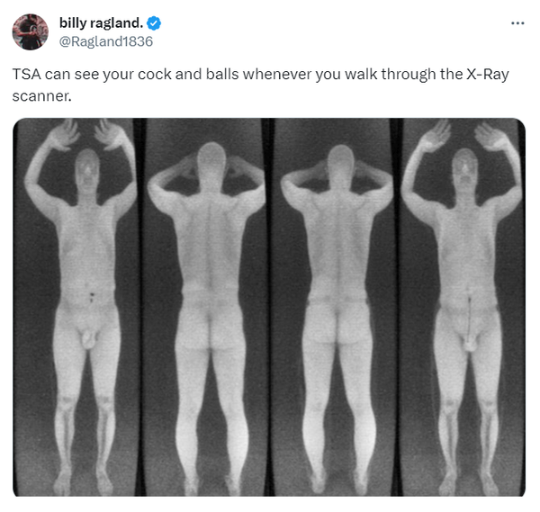 TSA body scans