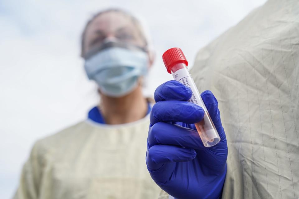 Jessica Hamilton, left, and  Amena Beslic of Beaumont Hospital use a viral transport solution to keep the coronavirus alive in Royal Oak, Mich., on March 16.