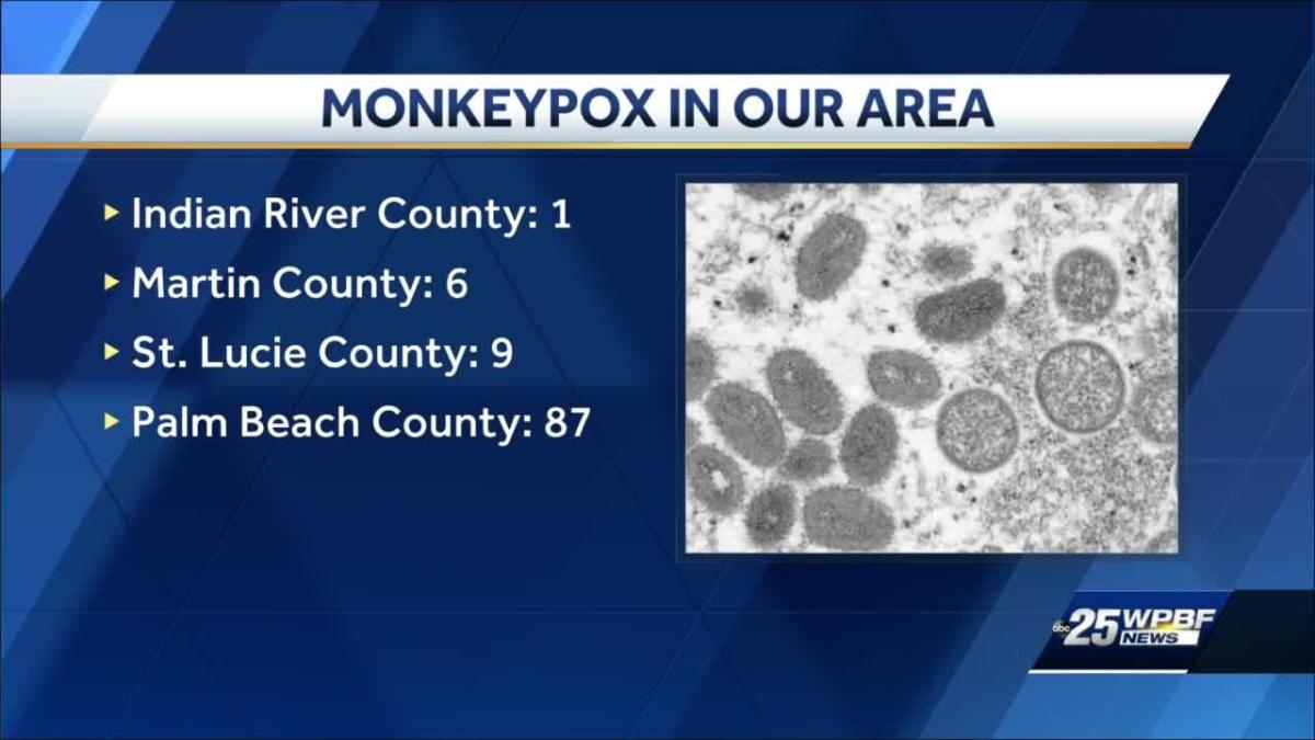 First case of monkeypox reported in Indian River County