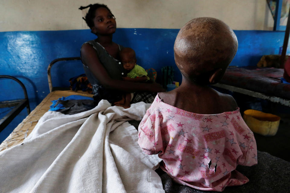 <p>Ntumbabu Kalubi, 4, an internally displaced and severely acute malnourished child waits to receive medical attention at the Tshiamala general referral hospital of Mwene Ditu in Kasai Oriental Province in the Democratic Republic of Congo, March 15, 2018. (Photo: Thomas Mukoya/Reuters) </p>