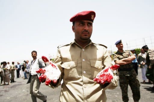 A Yemeni military policeman shows his bloodied gloves as he and colleagues collect evidence at the site of a suicide bomb attack in Sanaa on Monday. A Yemeni soldier packing powerful explosives under his uniform blew himself up in the middle of an army battalion in Sanaa, killing 96 troops and wounding around 300, a military official and medics say