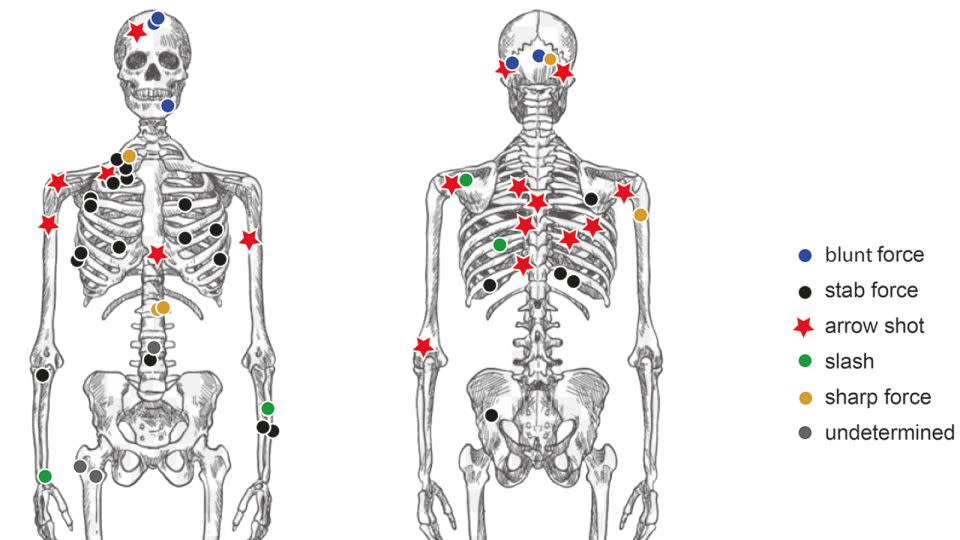 Researchers have catalogued the types of injuries inflicted on remains found in the Tollense Valley in an effort to understand how the conflict unfolded. - Ute Brinker