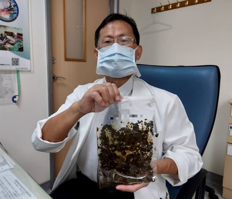 馮啟彥主任表示，郭先生膽結石數量驚人，應是他目前治療過的病人中最多的一位。（圖／大千綜合醫院提供）
