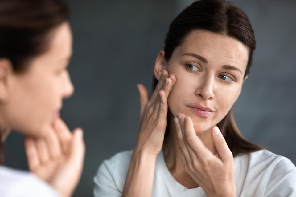 Close up unhappy sad woman looking at red acne spots on chin in mirror, upset young female dissatisfied by unhealthy skin, touching, checking dry irritated face skin, skincare and treatment concept