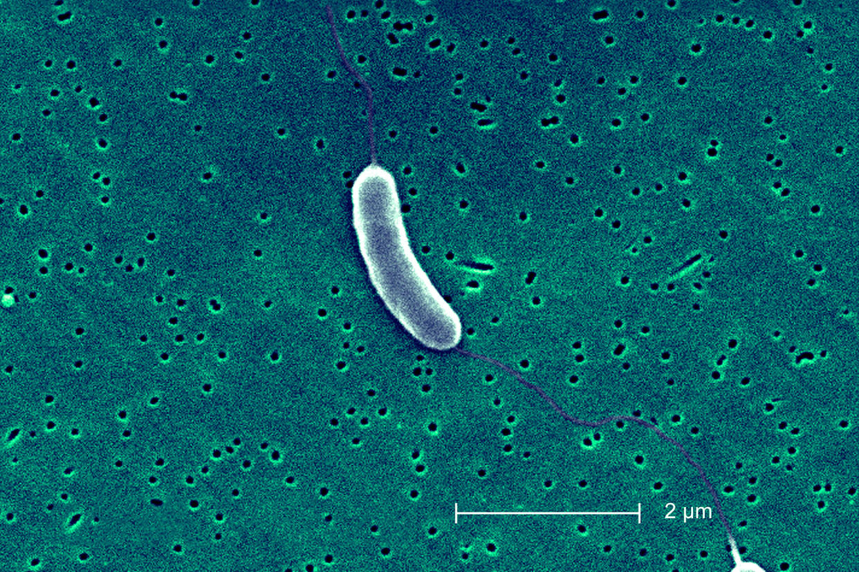 Vibrio Vulnificus Bacterium BSIP/UIG Via Getty Images