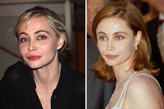 Emmanuelle Béart warnt vor Schönheitsoperation - nachdem ihre eigene schief ging (Bilder: Getty Images)