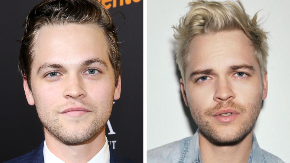 Alexander Calvert in 2016 and 2022