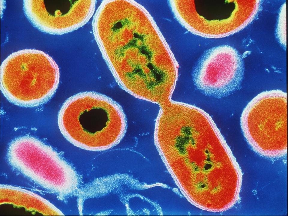 Listeria infections can be severe and even deadly for vulnerable people including those over 65 (Science Photo Library)