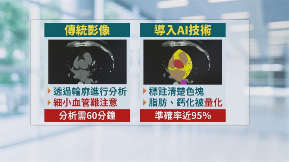 「心包油」恐丟命！　 新AI技術0.4秒就能揪出