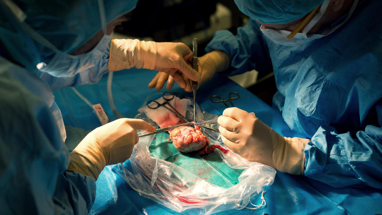  Doctors transplanting a kidney. 