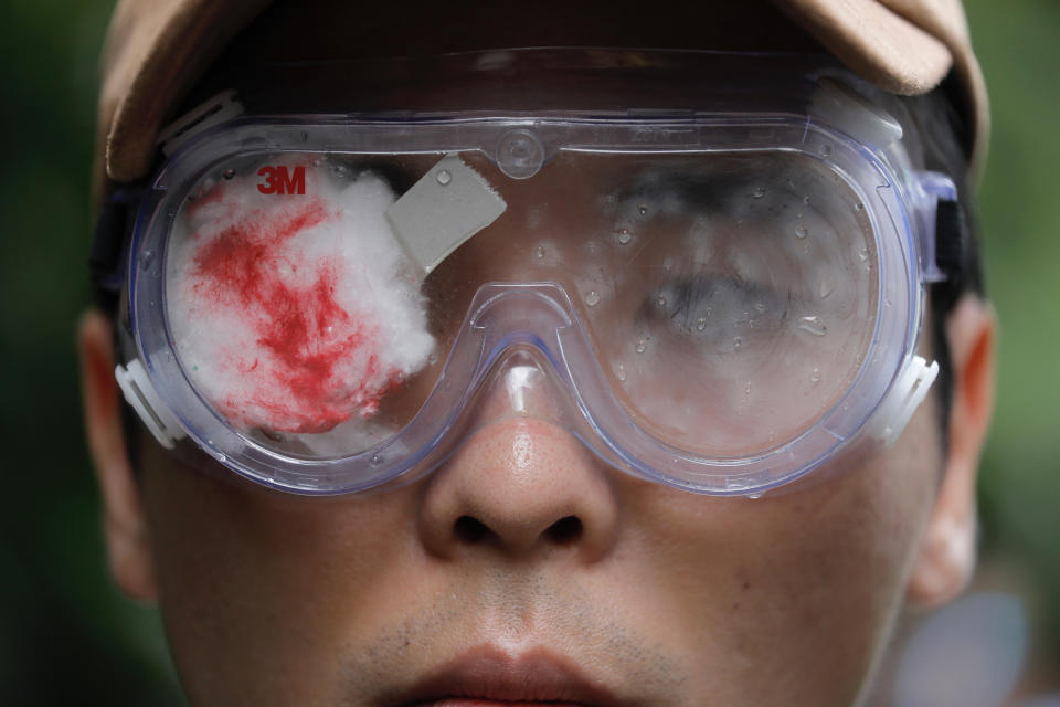 THIS ADDS TO CLARIFY A WOMAN'S EYE'S CONDITION - A pro-democracy protester with his eye covered in red-eyepatch, symbolizing a women reported to have had an eye ruptured by a beanbag round fired by police during clashes, participates in a march organized by teachers in Hong Kong Saturday, Aug. 17, 2019. Members of China's paramilitary People's Armed Police marched and practiced crowd control tactics at a sports complex in Shenzhen across from Hong Kong in what some interpreted as a threat against pro-democracy protesters in the semi-autonomous territory. (AP Photo/Vincent Yu)