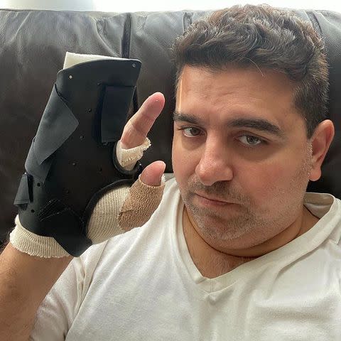 Buddy Valastro/Instagram Buddy Valastro hand injury