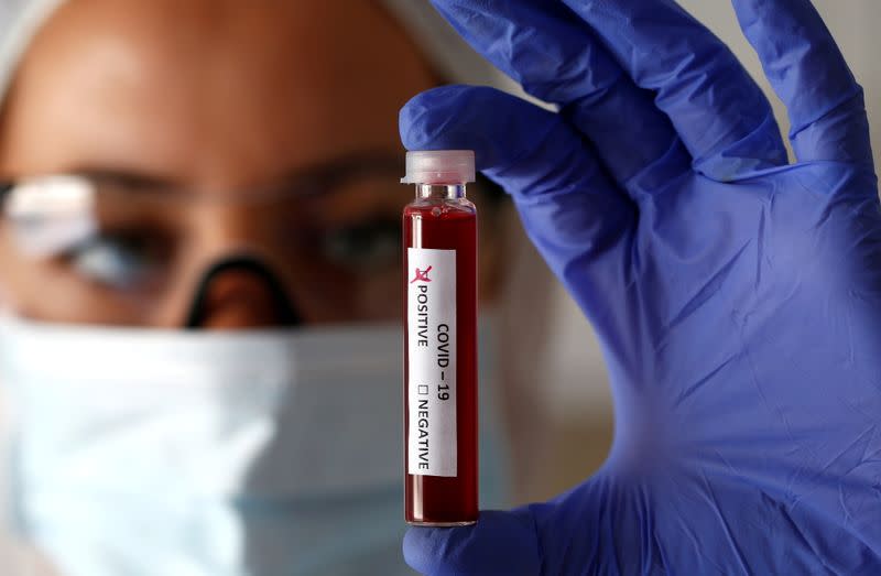 FILE PHOTO: Fake blood is seen in test tubes labelled with the coronavirus (COVID-19) in this illustration