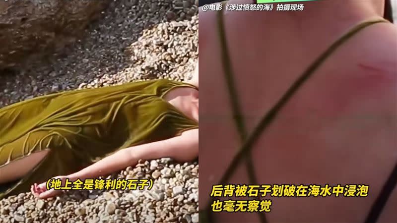 周迅美背因此受傷。（圖／翻攝自微博）