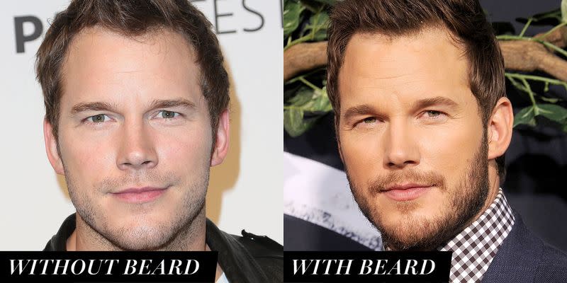 Chris Pratt