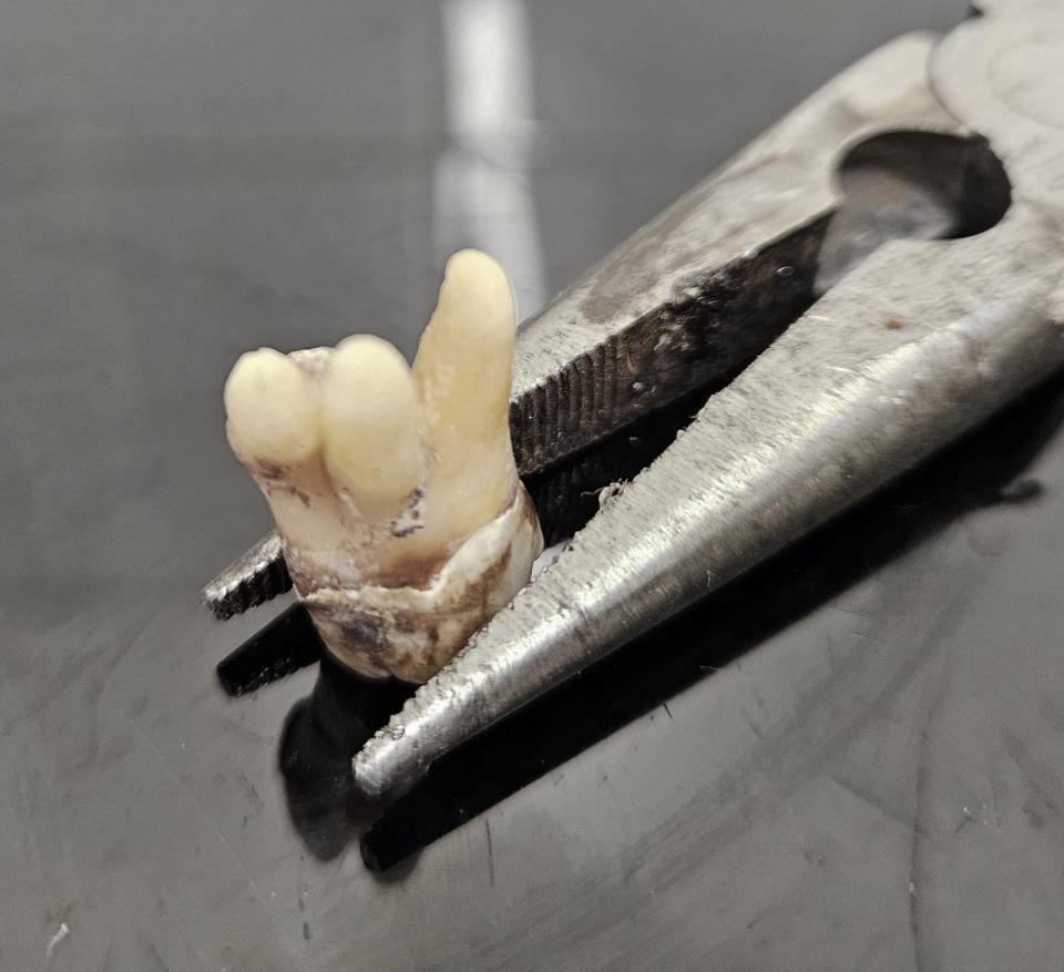 Langston's tooth had become loose and was causing constant pain, so he pulled it out with this pair of pliers. (Chris Langston / SWNS)
