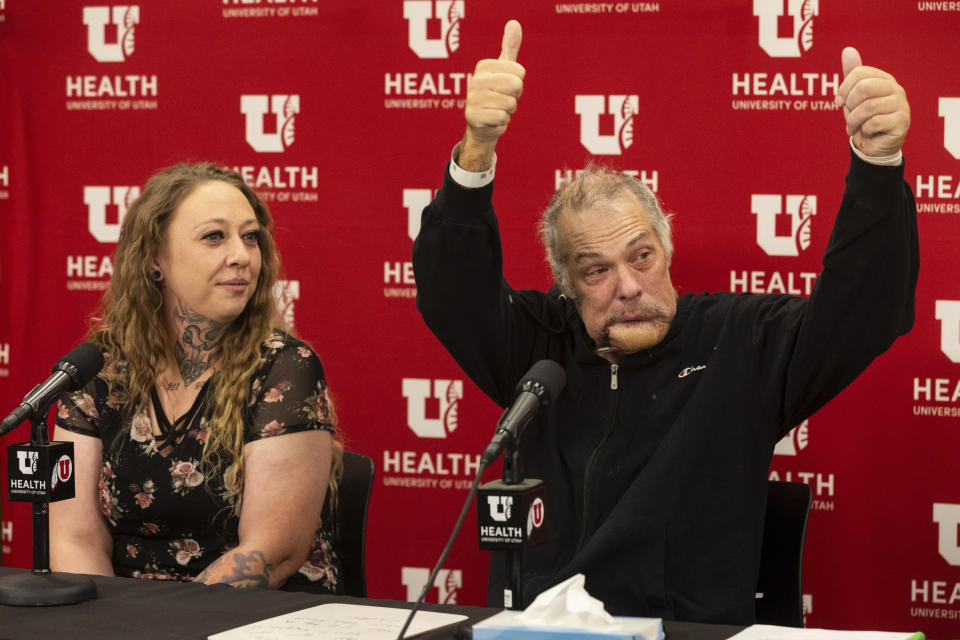 Rudy Noorlander gives two thumbs up at a press conference with his daughter, Ashley Noorlander, left, and surgeon to speak about his recovery from a grizzly bear attack at the University of Utah Hospital in Salt Lake City, on Friday, Oct. 13, 2023. Noorlander was attacked by a grizzly bear on Sept. 8, 2023, south of Big Sky, Mont. After emergency surgery in Bozeman, Noorlander was flown to the University of Utah Hospital where he has continued his care. (Megan Nielsen/The Deseret News via AP)