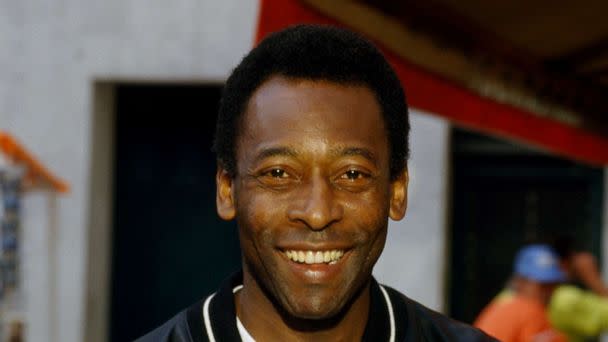 PHOTO: In this Aug. 6, 1987 file photo, Brazilian soccer champion Pele is shown. (Sygma via Getty Images, FILE)