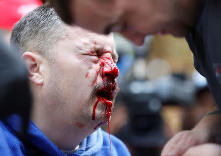 A pro-Trump supporter bleeds after being hit by a counter protester during the Patriots Day Free Speech Rally in Berkeley, California, U.S. April 15, 2017. REUTERS/Jim Urquhart