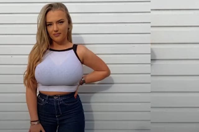 Student warned her 34J breasts could 'crush her spine' has them reduced in a private op