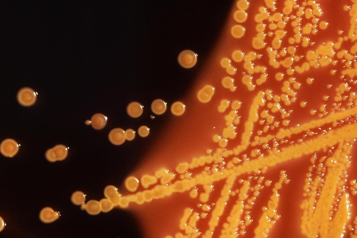 Colonies of E. coli bacteria grown on a Hektoen enteric (HE) agar plate are seen in a microscopic image courtesy of the U.S. Centers for Disease Control (CDC): REUTERS