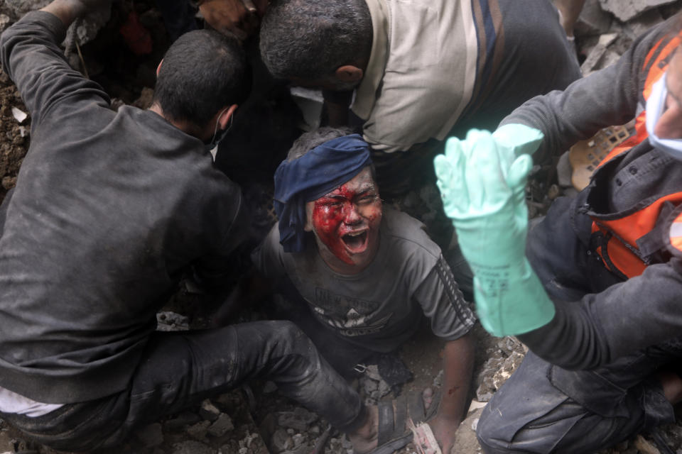 An injured Palestinian boy cries as rescuers try to pull him out of the rubble of a destroyed building following an Israeli airstrike in Bureij refugee camp, Gaza Strip, Thursday, Nov. 2, 2023. (AP Photo/Mohammed Dahman)