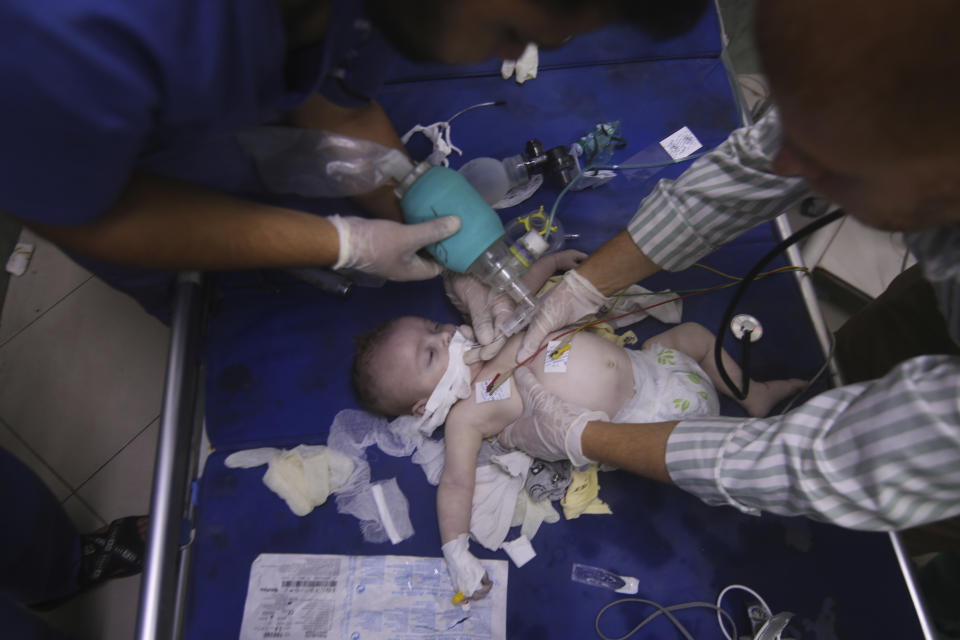 A Palestinian baby wounded in Israeli strikes is treated at Al-Najar hospital in Rafah, Gaza Strip, Friday, Oct. 13, 2023. (AP Photo/Hatem Ali)