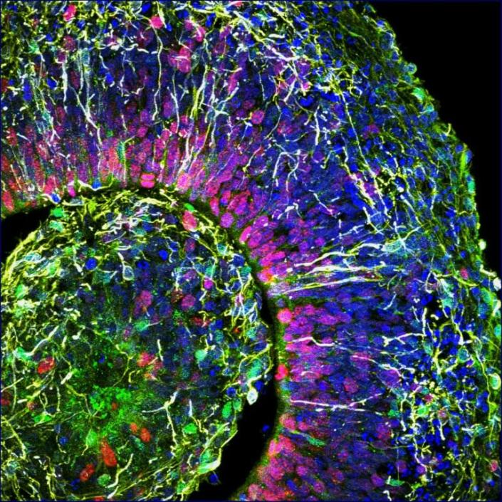 A cross-section of a brain organoid, showing the initial formation of a cortical plate, with each color marking a different type of brain cell (AFP Photo/HO)