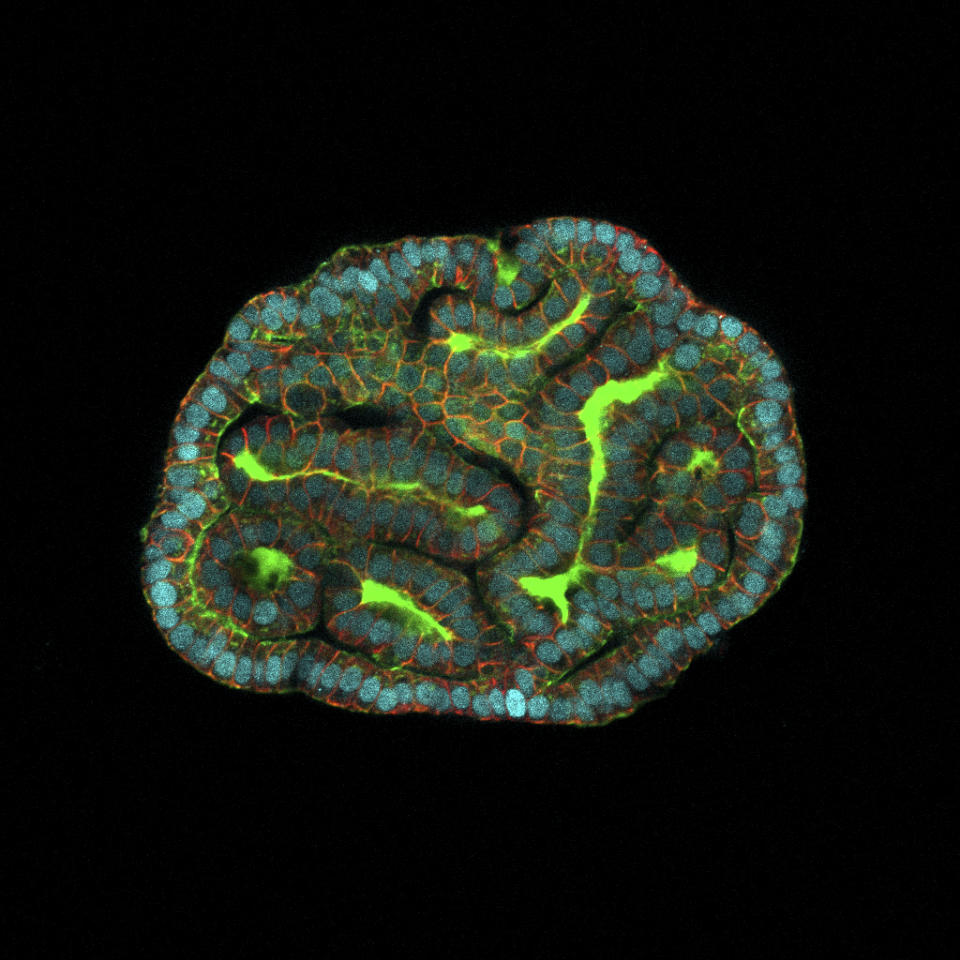 This microscope image provided by researchers in March 2024 shows a kidney organoid resembling renal tubules, created from cells collected from amniotic fluid. In a study published Monday, March 4, 2024, in the journal Nature Medicine, scientists in the United Kingdom described how they have made mini-organs from cells floating in amniotic fluid – an advance they believe could open up new areas of prenatal medicine. (Giuseppe Calà, Paolo De Coppi, Mattia Gerli via AP)