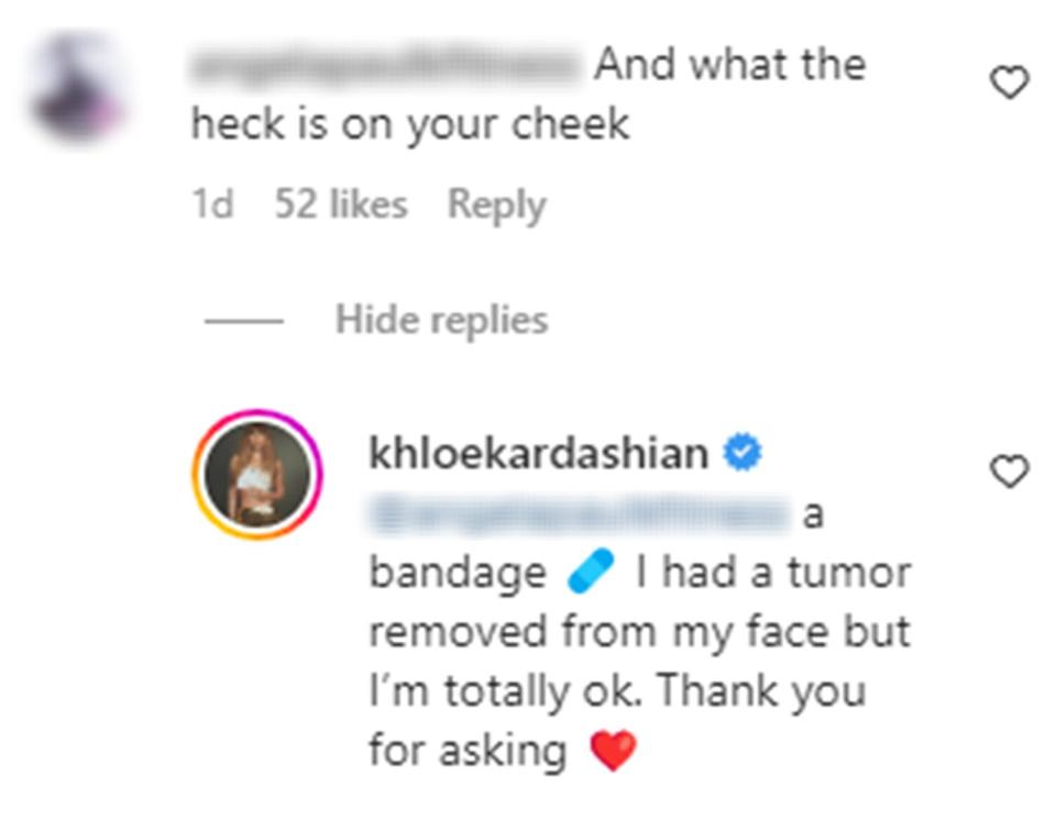 Khloe Kardashian Reveals She’s Had a Tumor Removed From Her Face: 'I'm Totally Ok'