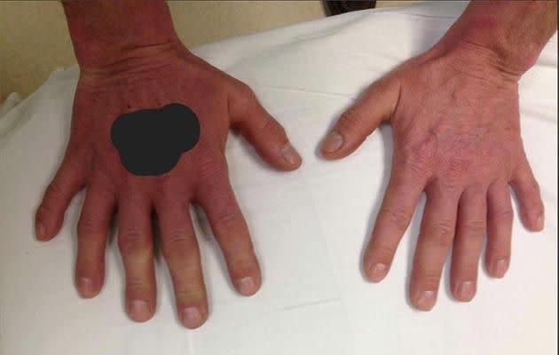 A doctor has shared this image of a man's hands online. Photo: Figure 1