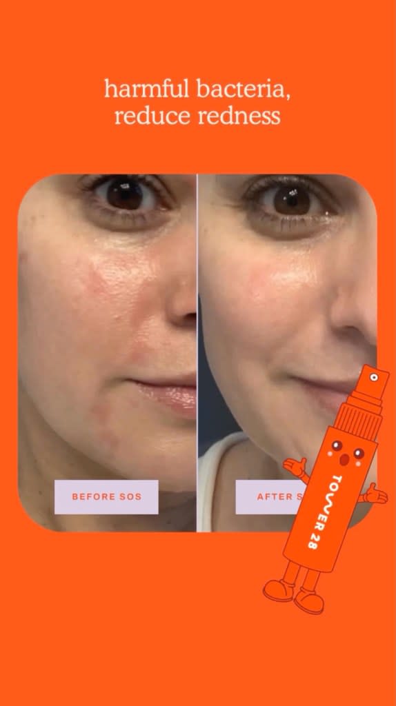 Hypocholorous acid is “helpful for those dealing with breakouts, and the spray formulation makes it a great option for post-workout,” Garshick shared. Tower 28 Beauty/Instagram