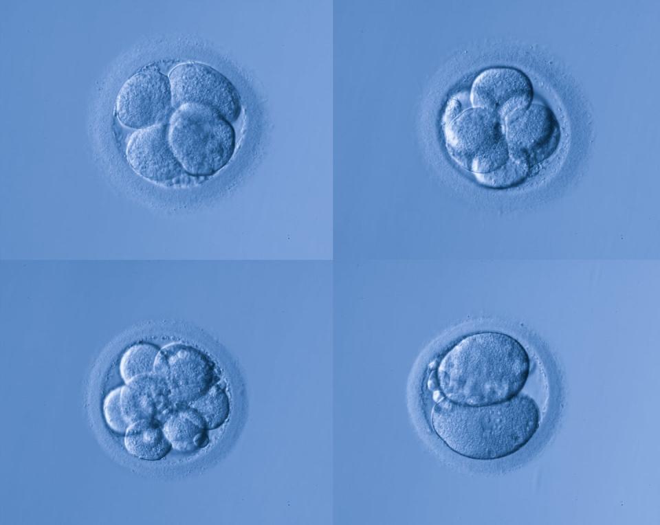 As many as three out of four human embryos naturally die in the development process. <a href="https://www.gettyimages.com/detail/photo/human-egg-royalty-free-image/509171917" rel="nofollow noopener" target="_blank" data-ylk="slk:Red Hayabusa/iStock via Getty Images Plus;elm:context_link;itc:0;sec:content-canvas" class="link ">Red Hayabusa/iStock via Getty Images Plus</a>