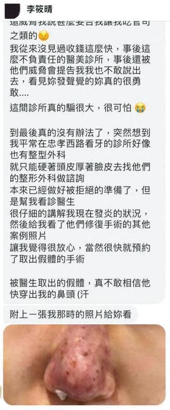 有網友在莉亞粉絲專頁留言說在元和雅整形失敗，結果被檢警查出是莉亞辦假帳號自導自演。照片則是來路不明。（翻攝Lia 莉亞臉書）