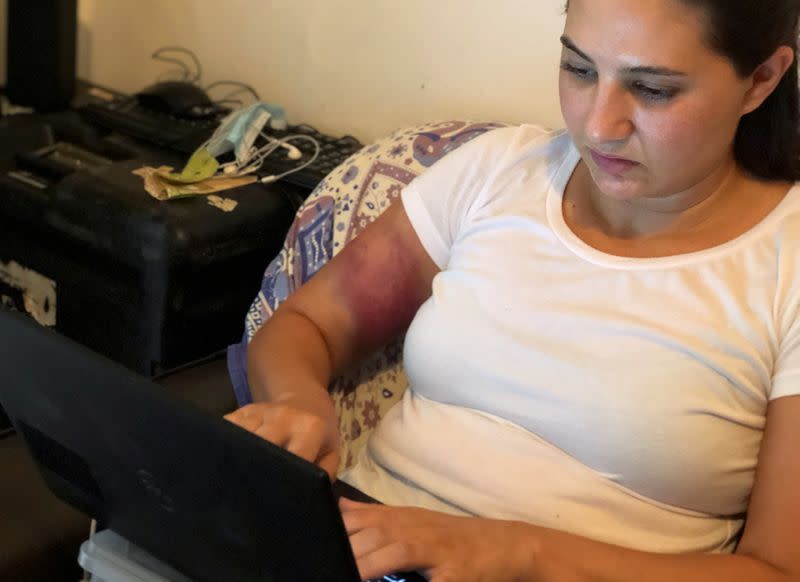 Reuters senior television producer Ayat Basma works on her laptop with a bruise visible on her hand, following a blast in Beirut's port area