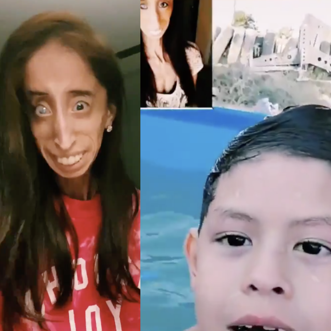 Anti-bullying and disability activist speaks out against hurtful TikTok trend. (Photo: Twitter)