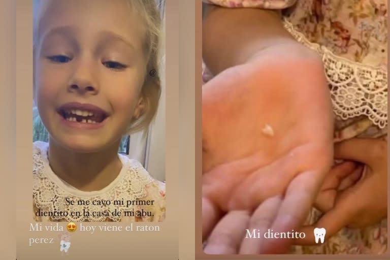 Luciana Salazar mostró que a Matilda se le cayó su primer diente de leche