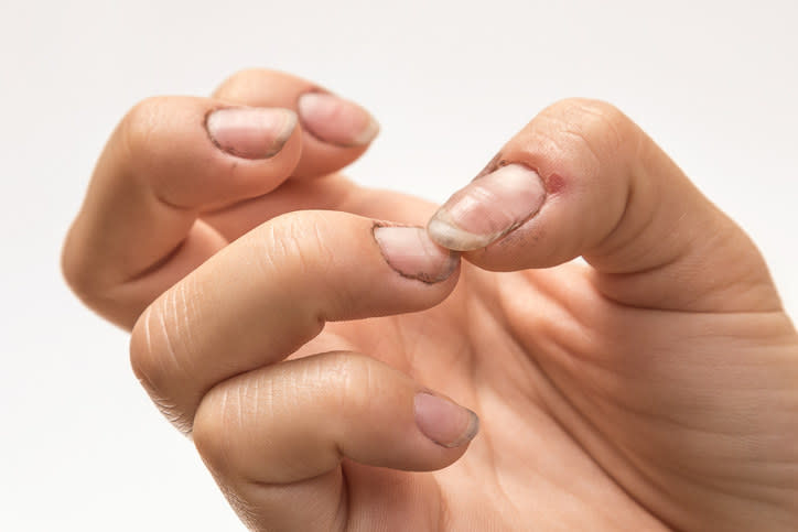 hands with dirty nails