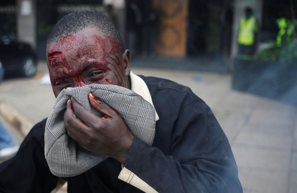Protester beaten by Kenya policemen bleeds during clashes in Nairobi, Kenya, May 16, 2016. (Reuters/Goran Tomasevic)