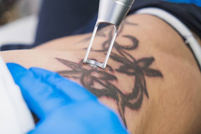Close-up of tattoo procedure on skin