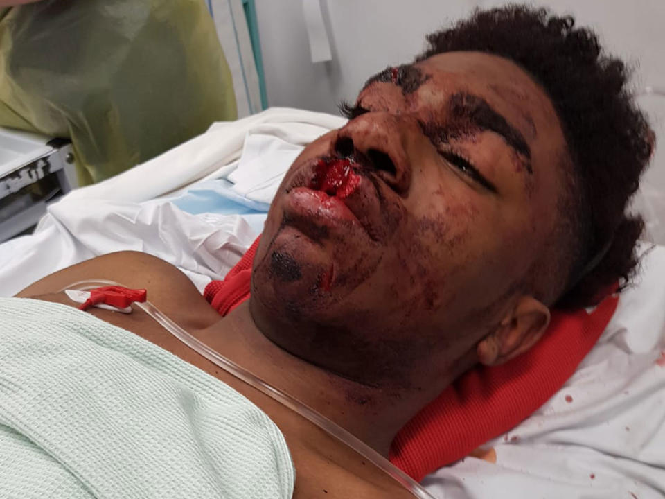 Terrell Decosta Jones-Burton, 15, was injured while being detained by the Metropolitan Police on 21 November: Shereen Jones