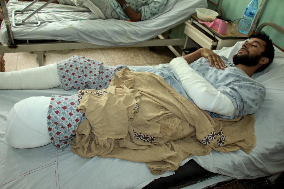 <p>An Afghan man who was injured in a bomb blast a few days ago receives medical treatment at a hospital in Arghandab district of Kandahar, Afghanistan, 15 April 2021</p> (EPA)