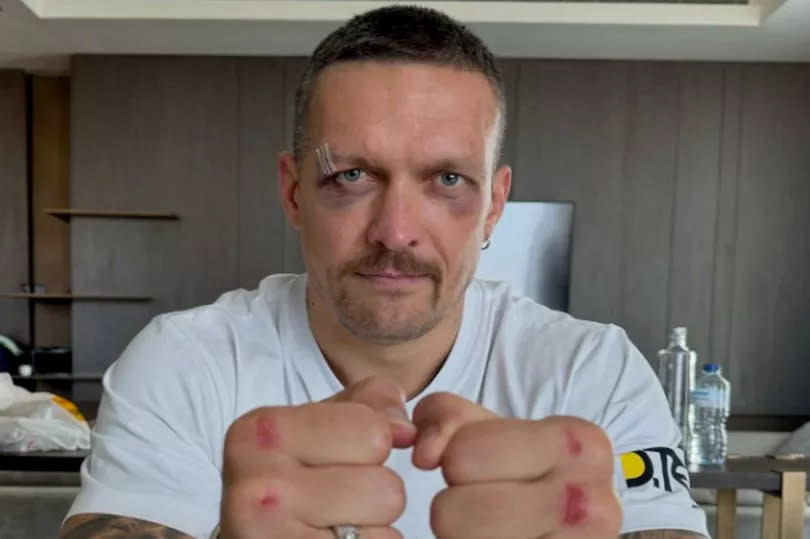 Oleksandr Usyk sustained heavy damage during his win over Tyson Fury