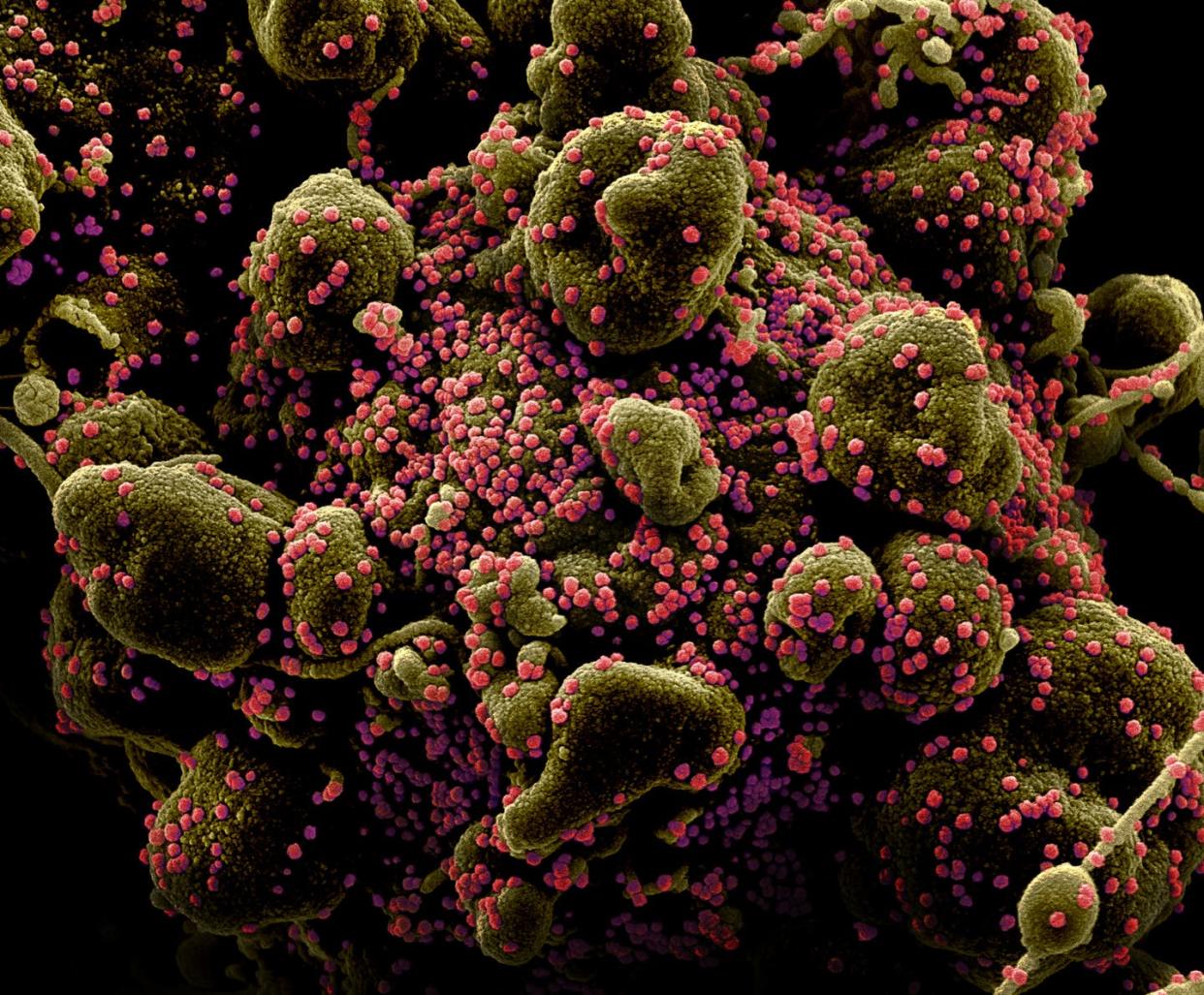 <span class="caption">SARS-CoV-2 virus particles (pink dots) on a dying cell</span> <span class="attribution"><a class="link " href="https://www.flickr.com/photos/nihgov/49692246187/in/photostream/" rel="nofollow noopener" target="_blank" data-ylk="slk:National Institute of Allergy and Infectious Diseases, NIH;elm:context_link;itc:0;sec:content-canvas">National Institute of Allergy and Infectious Diseases, NIH</a></span>